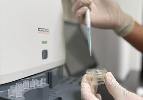 Een persoon poetst de tanden van een kleine witte en bruine hond met een rode tandenborstel.